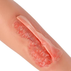 Wearable Arm Trauma Skin Model