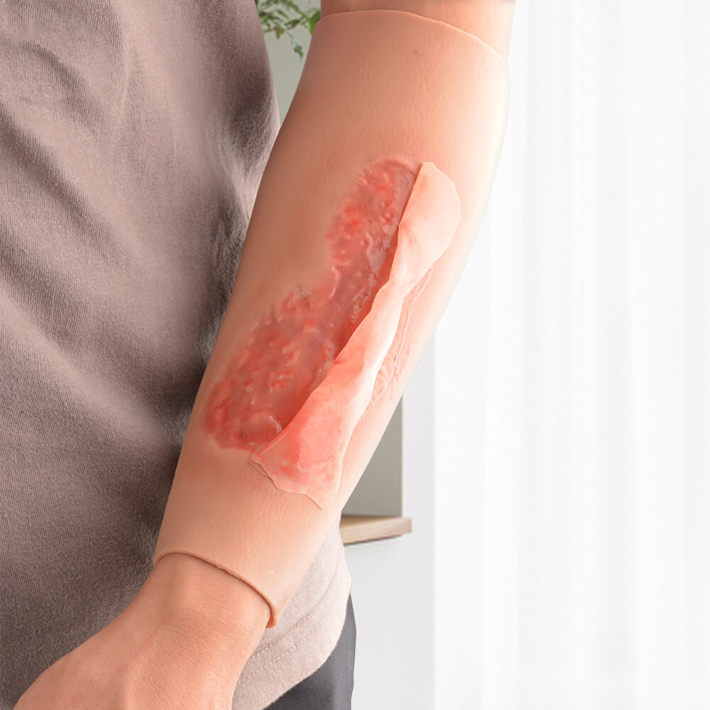 Arm Trauma Care Model