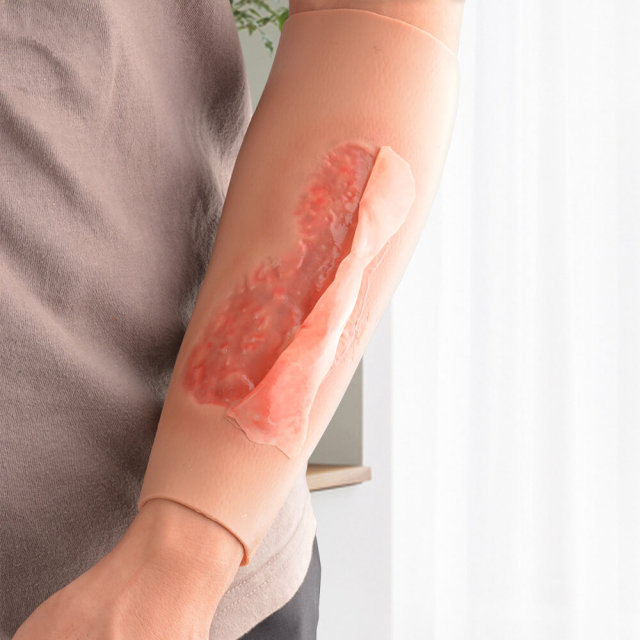 Arm Trauma Care Model