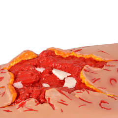 Simulated blast wounds in the legs