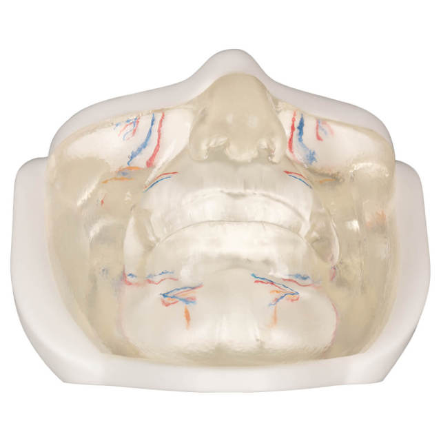 Transparent Lower Face Injection & Thread Lifting Practice Model with Simulated Blood Vessels