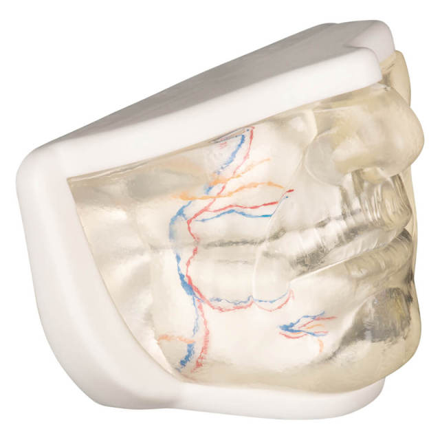 Transparent Lower Face Injection & Thread Lifting Practice Model with Simulated Blood Vessels