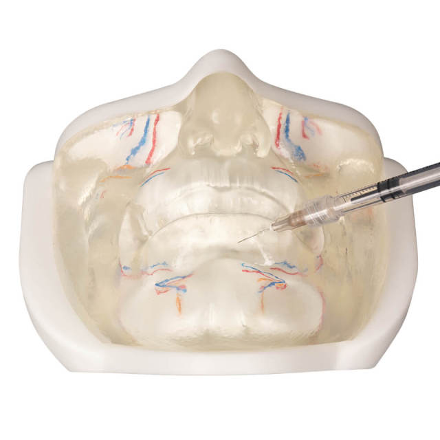 Transparent Lower Face Injection & Thread Lifting Practice Model with Simulated Blood Vessels