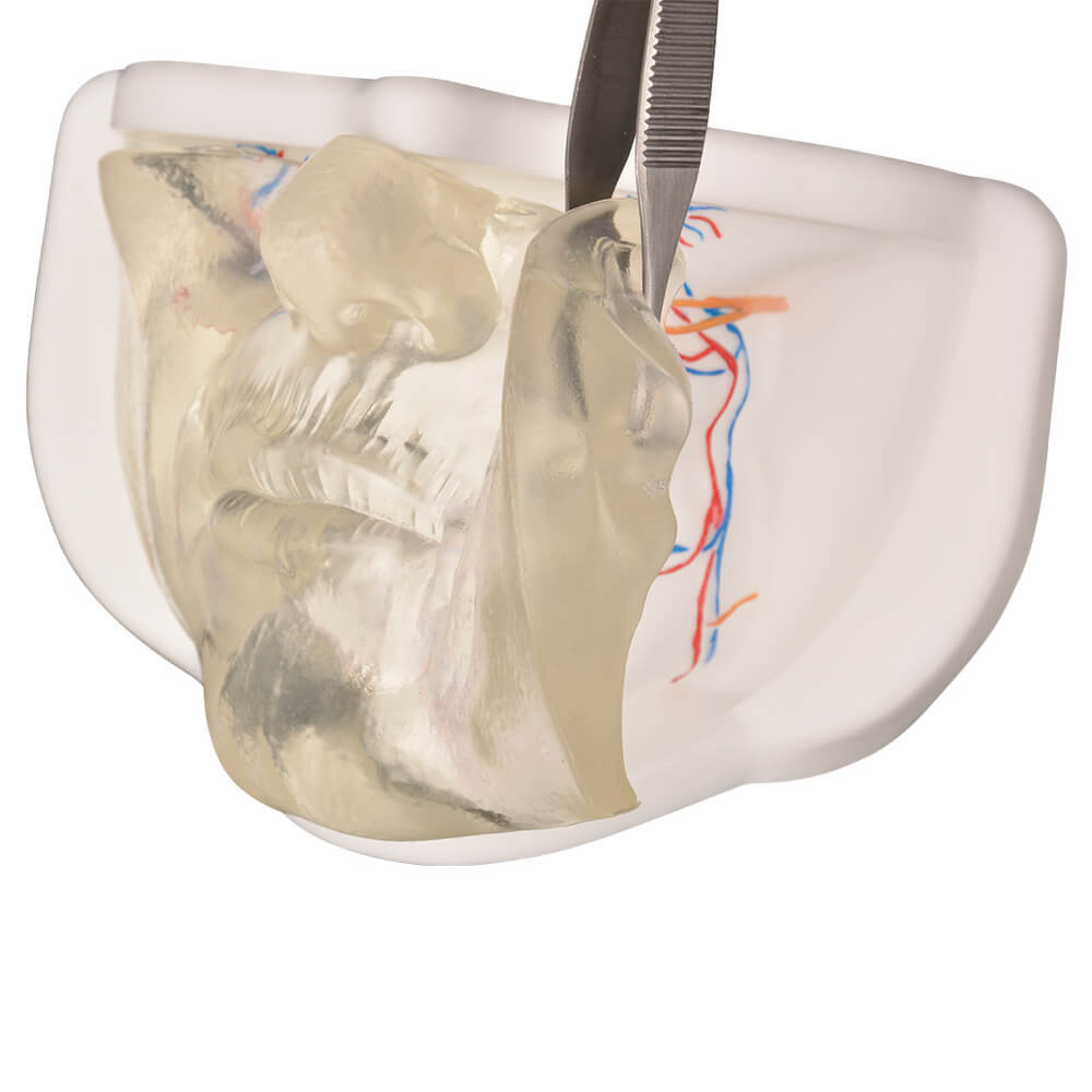Transparent Lower Face Injection & Thread Lifting Practice Model with Simulated Blood Vessels