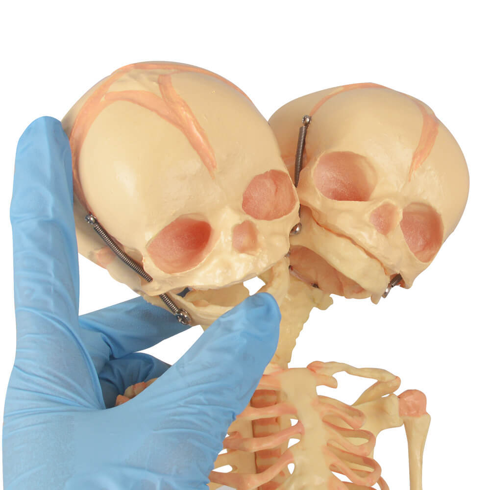 Mini Infant Skeleton Model with Double Skulls