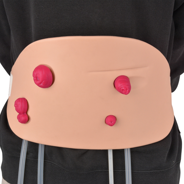 Wearable Ostomy Care Simulator