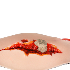 Wearable Wound Abdominal Model