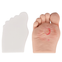 Science Medical Diabetic Foot Grading Pegboard Model, Diabetes Mellitus