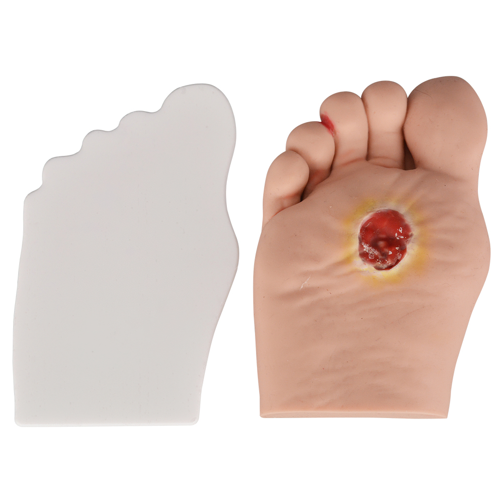 Science Medical Diabetic Foot Grading Pegboard Model, Diabetes Mellitus
