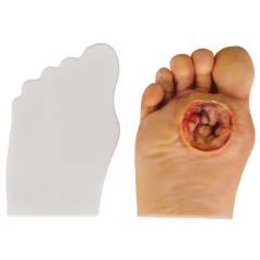 Science Medical Diabetic Foot Grading Pegboard Model, Diabetes Mellitus
