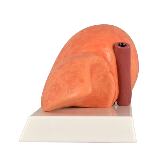Silicone Liver Simulation Model with Non-Alcoholic Fatty Liver Disease
