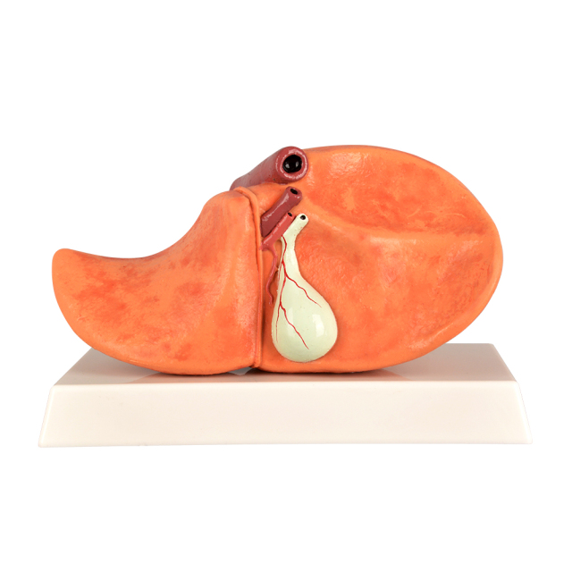 Silicone Liver Simulation Model with Non-Alcoholic Fatty Liver Disease