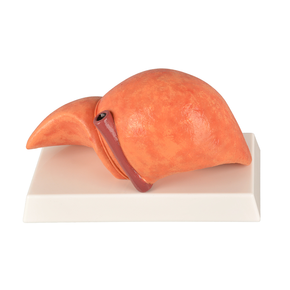 Silicone Liver Simulation Model with Non-Alcoholic Fatty Liver Disease