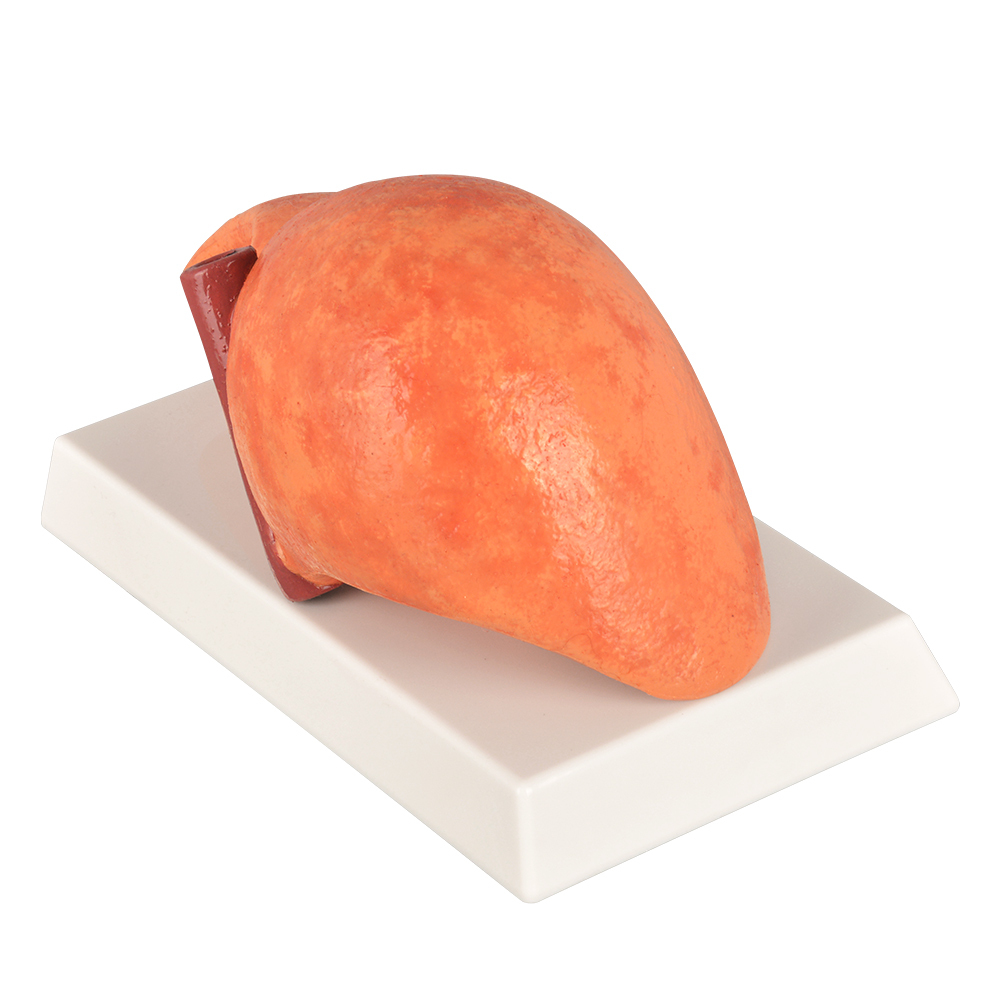 Silicone Liver Simulation Model with Non-Alcoholic Fatty Liver Disease