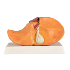 Human Pathological Liver Model with Alcoholic Liver Disease, Silicone
