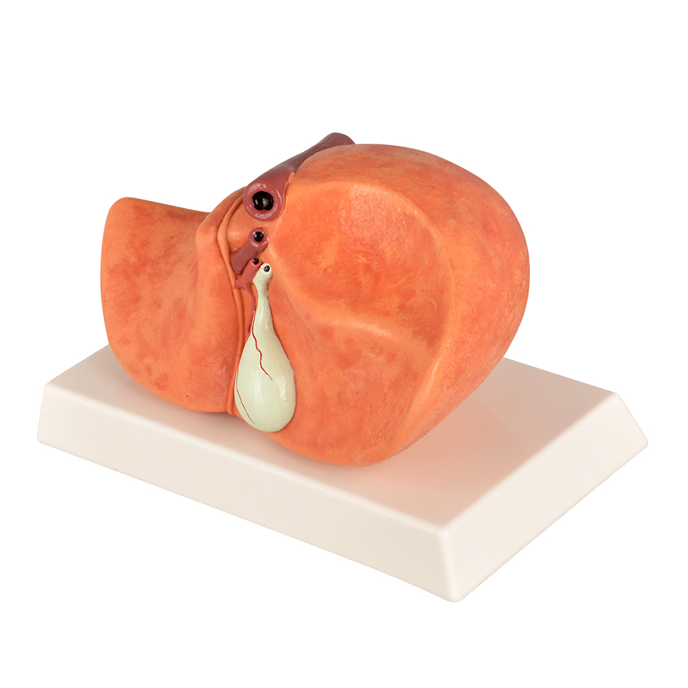 Silicone Liver Simulation Model with Non-Alcoholic Fatty Liver Disease