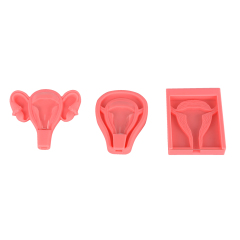 Uterus-shaped 3D IUD Training Model for OB/GYN Education