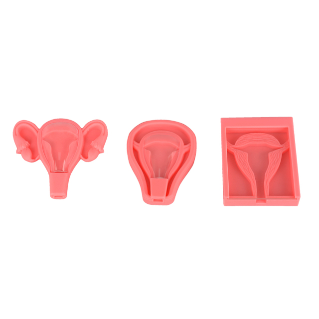 Uterus-shaped 3D IUD Training Model for OB/GYN Education
