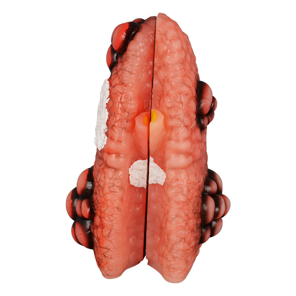 Cough Up Lung Model