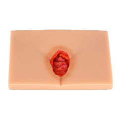 Silicone Pressure Ulcer (Stage 1-4) Demonstration and Care Model