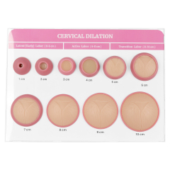 Cervical Effacement and Dilation Model 1-10cm