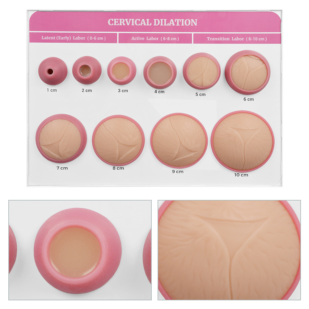 Cervical Effacement and Dilation Model 1-10cm