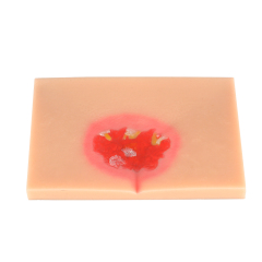 Silicone Pressure Ulcer (Stage 1-4) Demonstration and Care Model