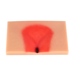 Silicone Pressure Ulcer (Stage 1-4) Demonstration and Care Model