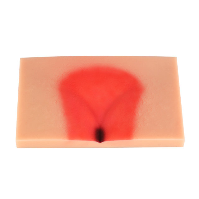 Silicone Pressure Ulcer (Stage 1-4) Demonstration and Care Model