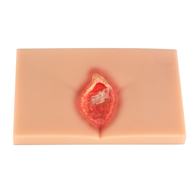Silicone Pressure Ulcer (Stage 1-4) Demonstration and Care Model