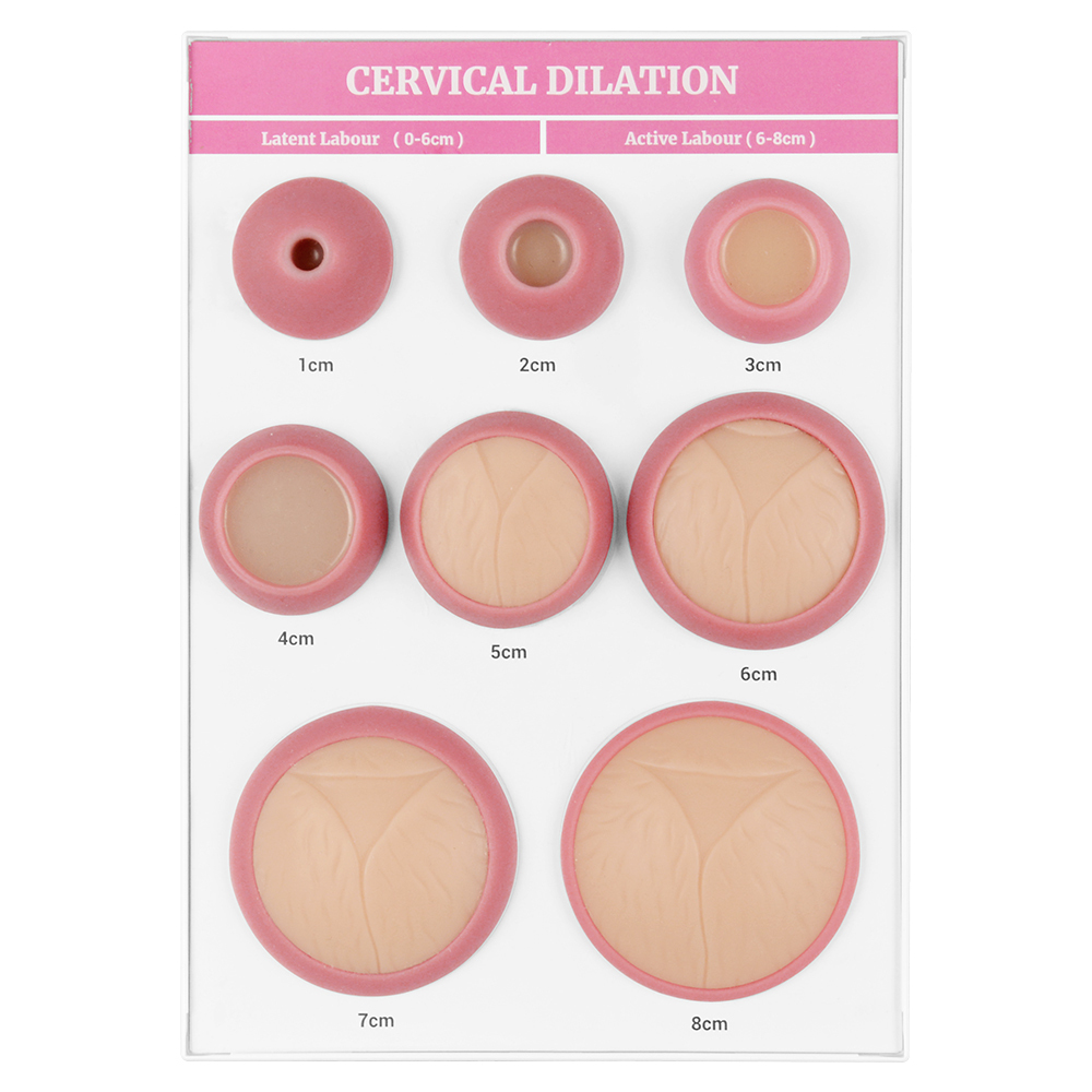 Cervical Dilation Model, 1-8 cm