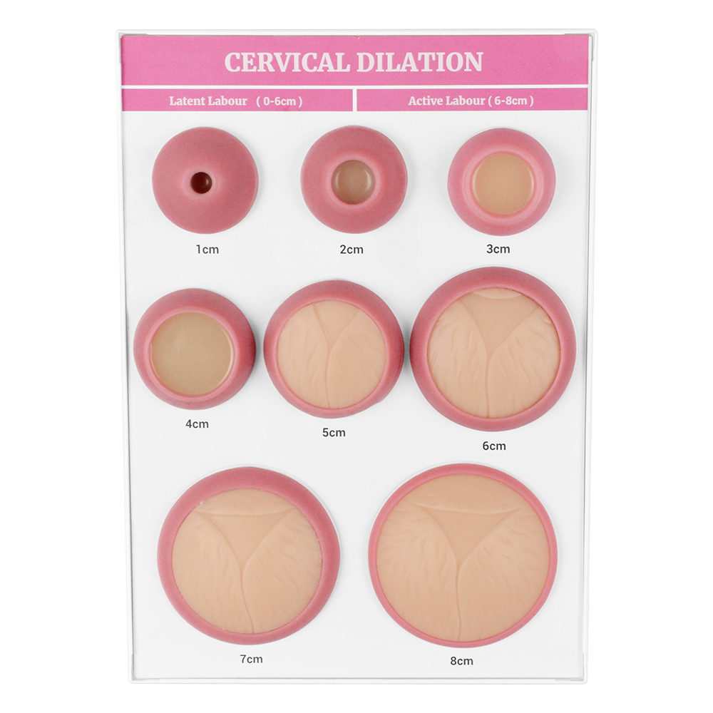 Cervical Dilation Model, 1-8 cm