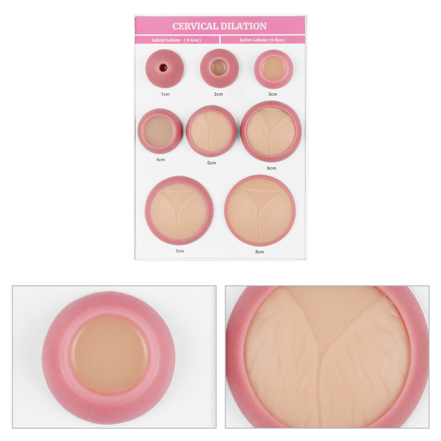 Cervical Dilation Model, 1-8 cm