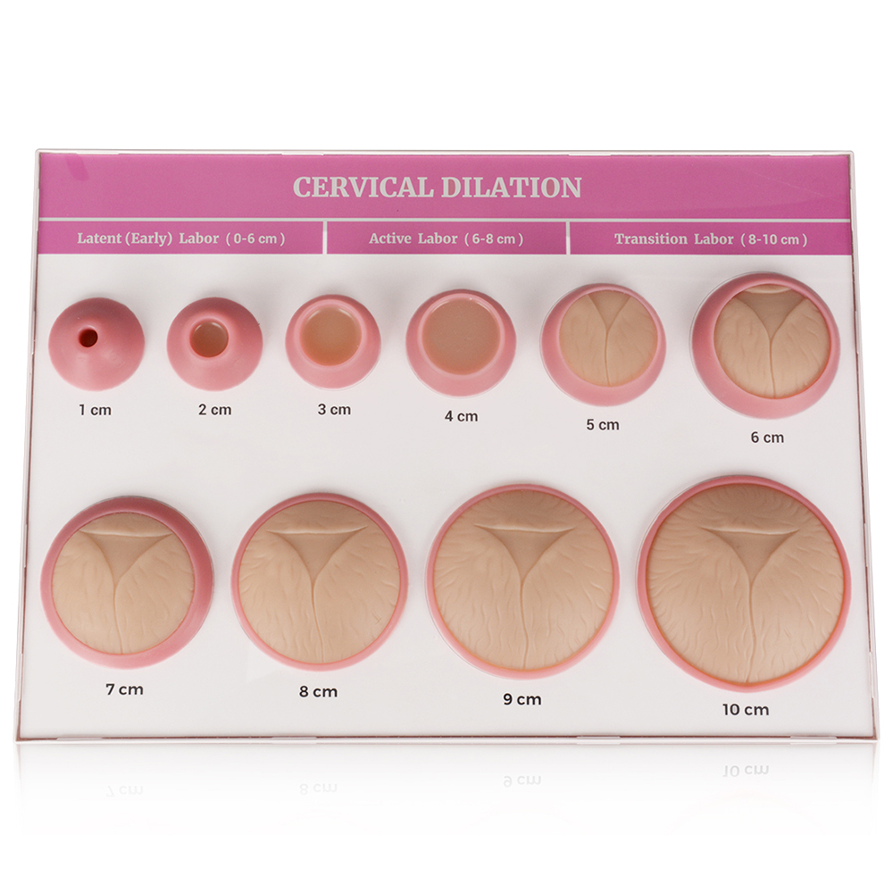 Cervical Effacement and Dilation Model 1-10cm