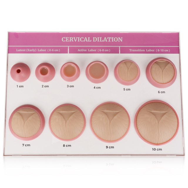Cervical Effacement and Dilation Model 1-10cm