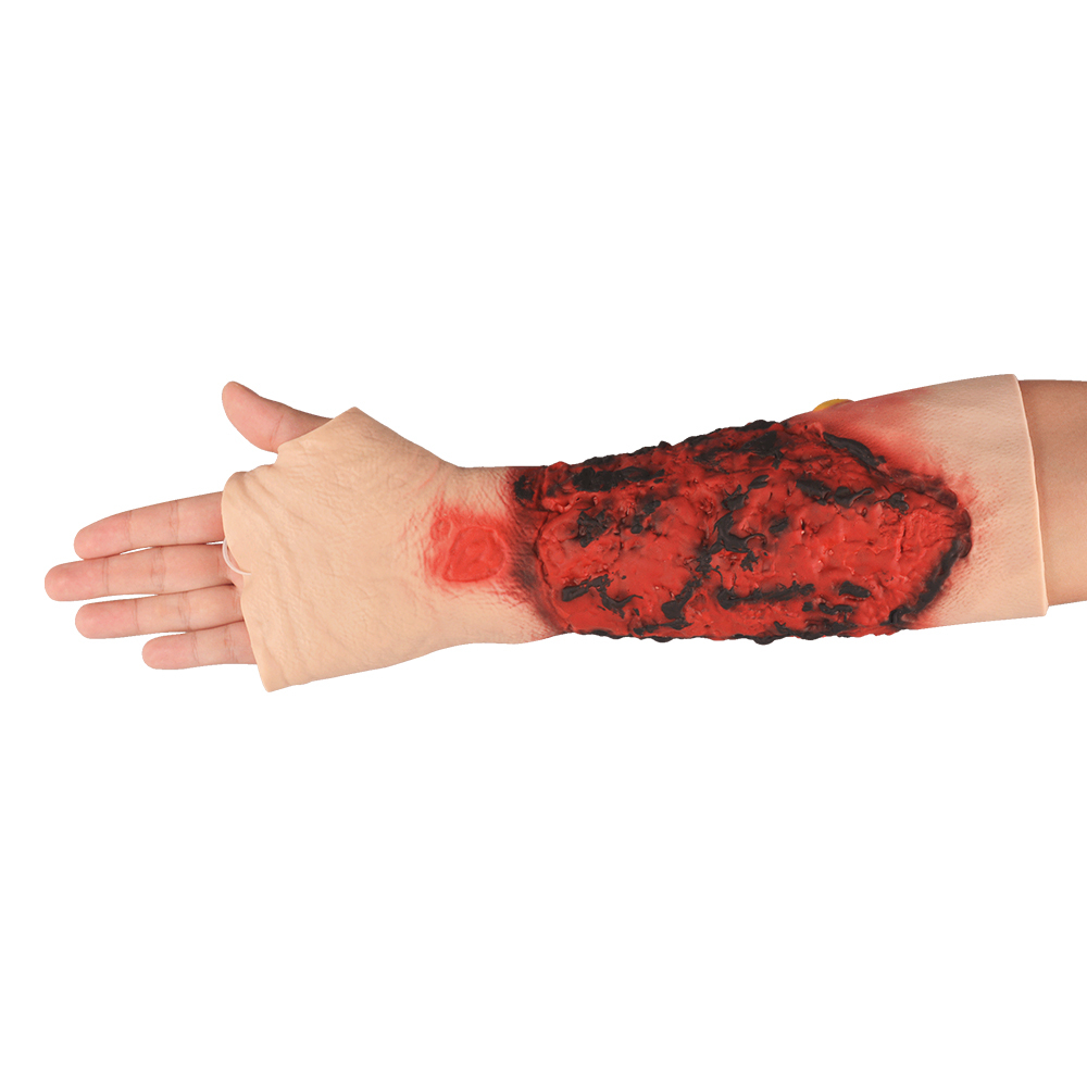 Wearable Burn Wound Lower Arm Sleeve Model
