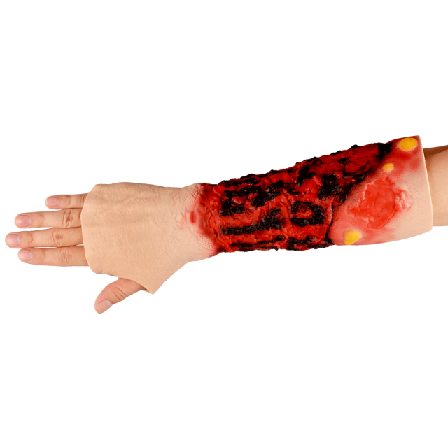 Wearable Burn Wound Lower Arm Sleeve Model
