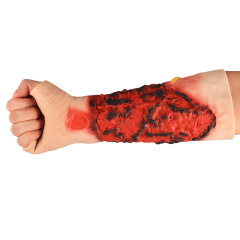 Wearable Burn Wound Lower Arm Sleeve Model