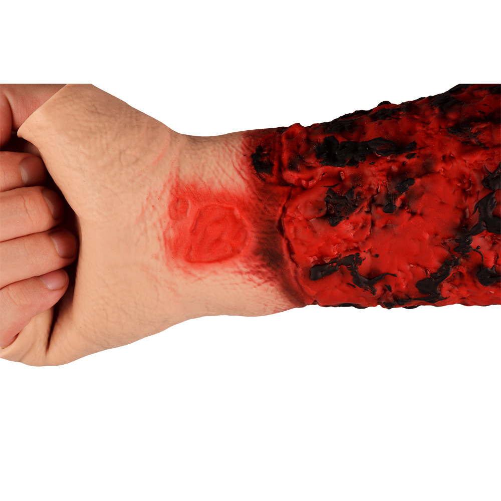 Wearable Burn Wound Lower Arm Sleeve Model