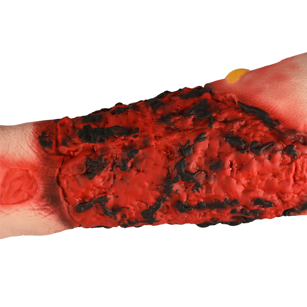 Wearable Burn Wound Lower Arm Sleeve Model