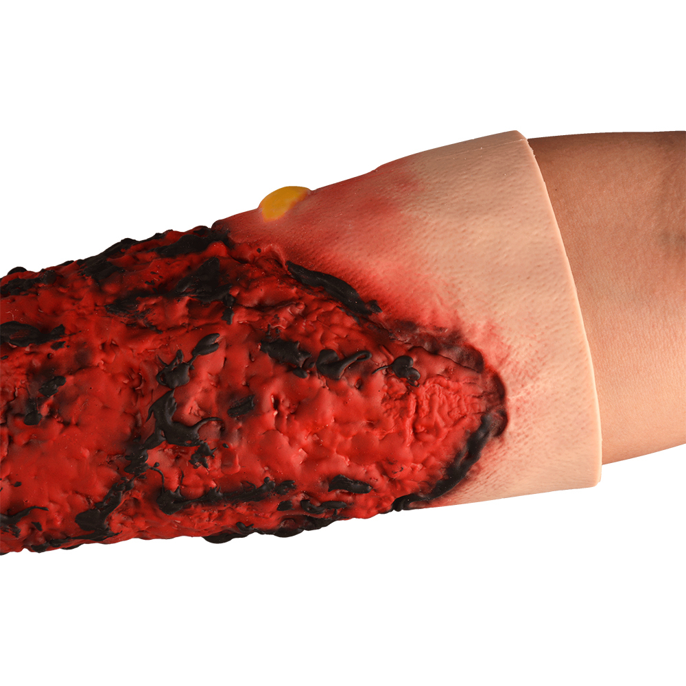 Wearable Burn Wound Lower Arm Sleeve Model