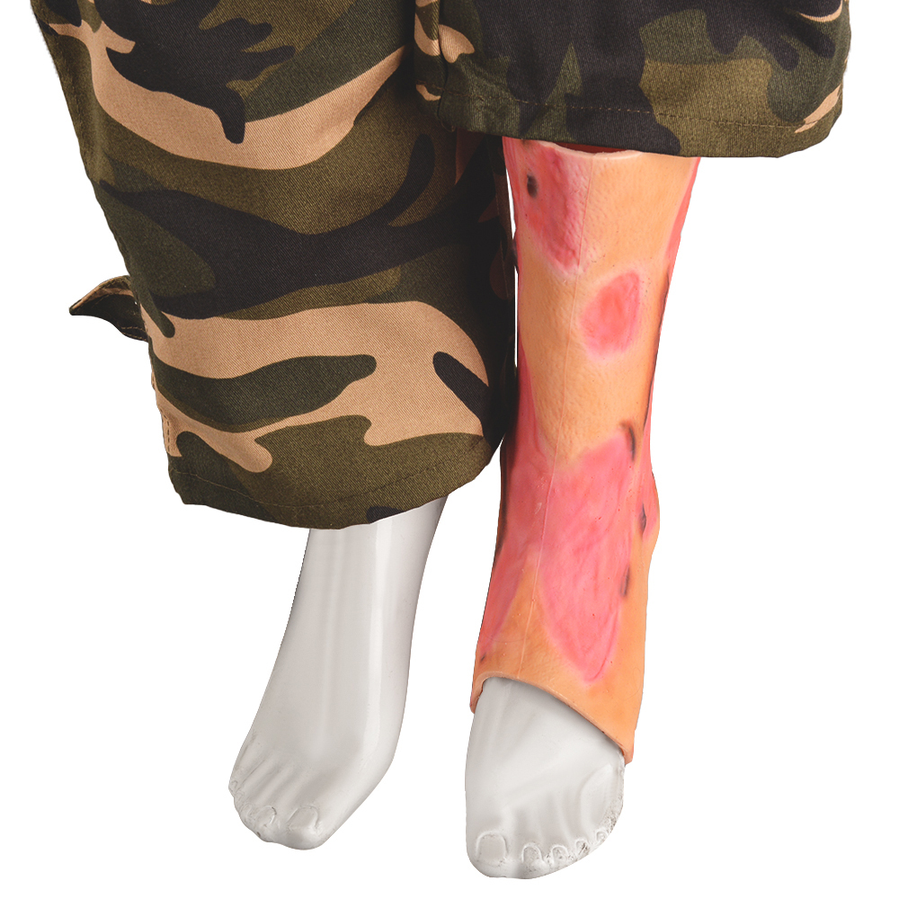 Silicone Sleeve for Ankle Burn Simulation