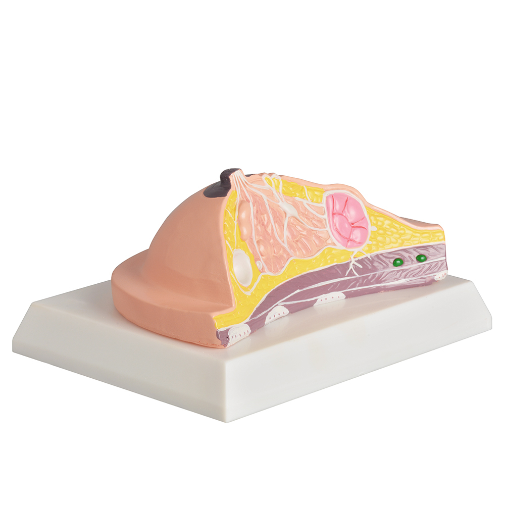 Anatomy Breast Model with Common Diseases