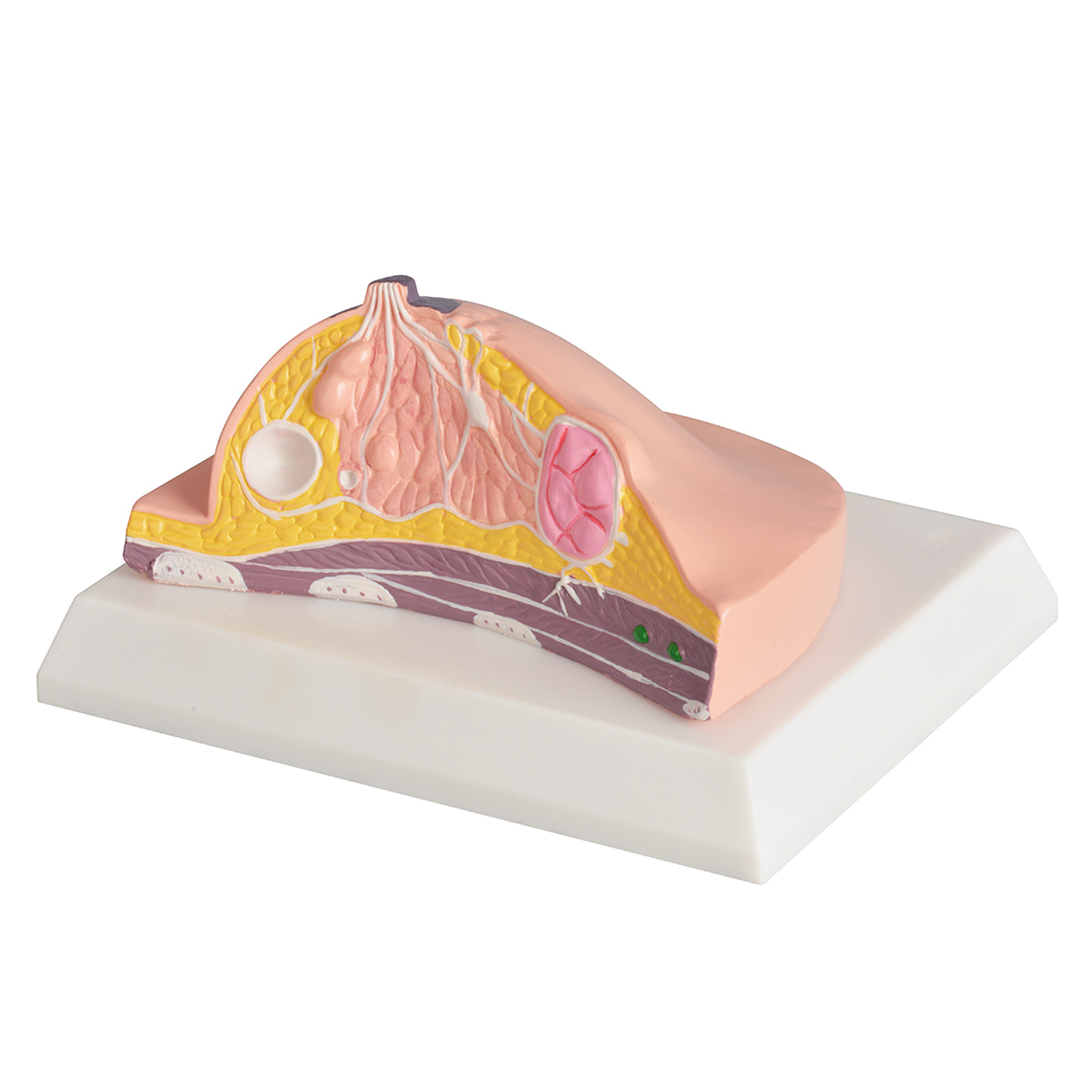Anatomy Breast Model with Common Diseases