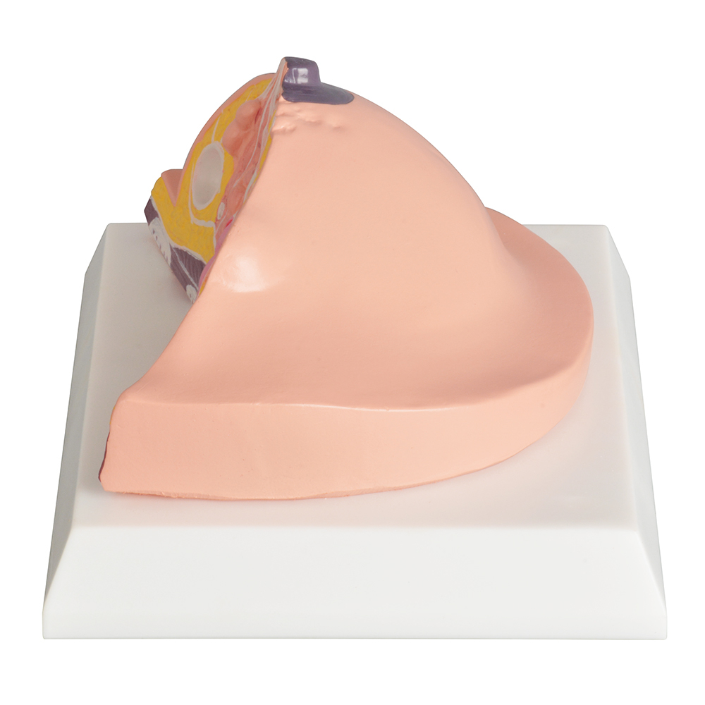 Anatomy Breast Model with Common Diseases