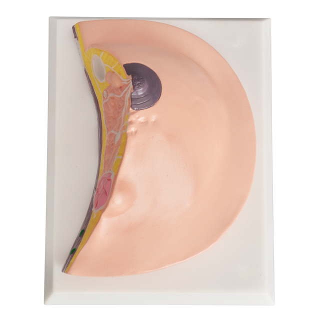 Anatomy Breast Model with Common Diseases