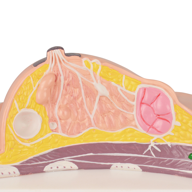 Anatomy Breast Model with Common Diseases