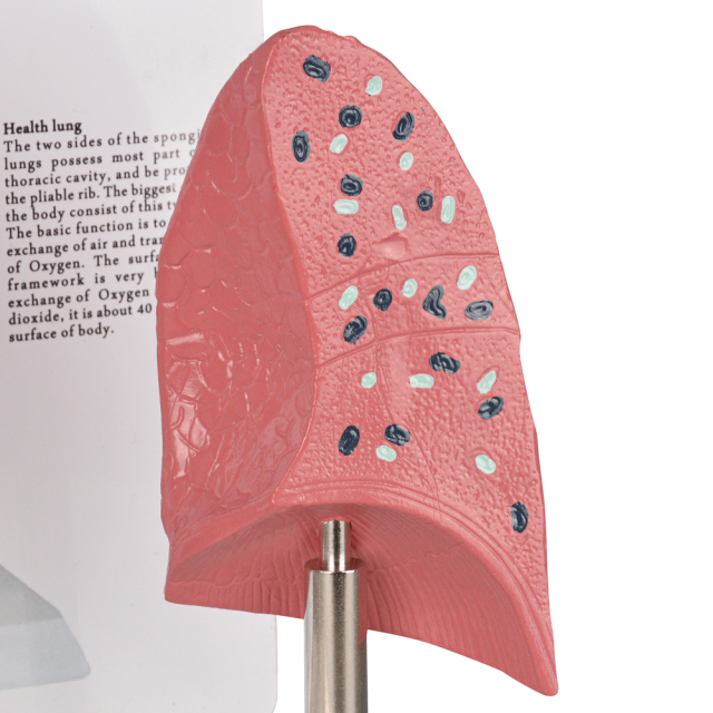 Healthy vs Smoker Lung Model