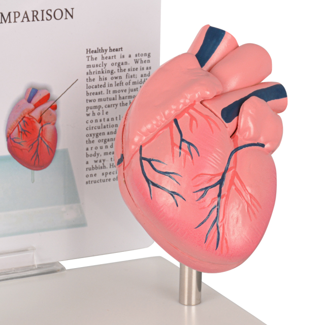 Healthy vs Smoker Heart Model