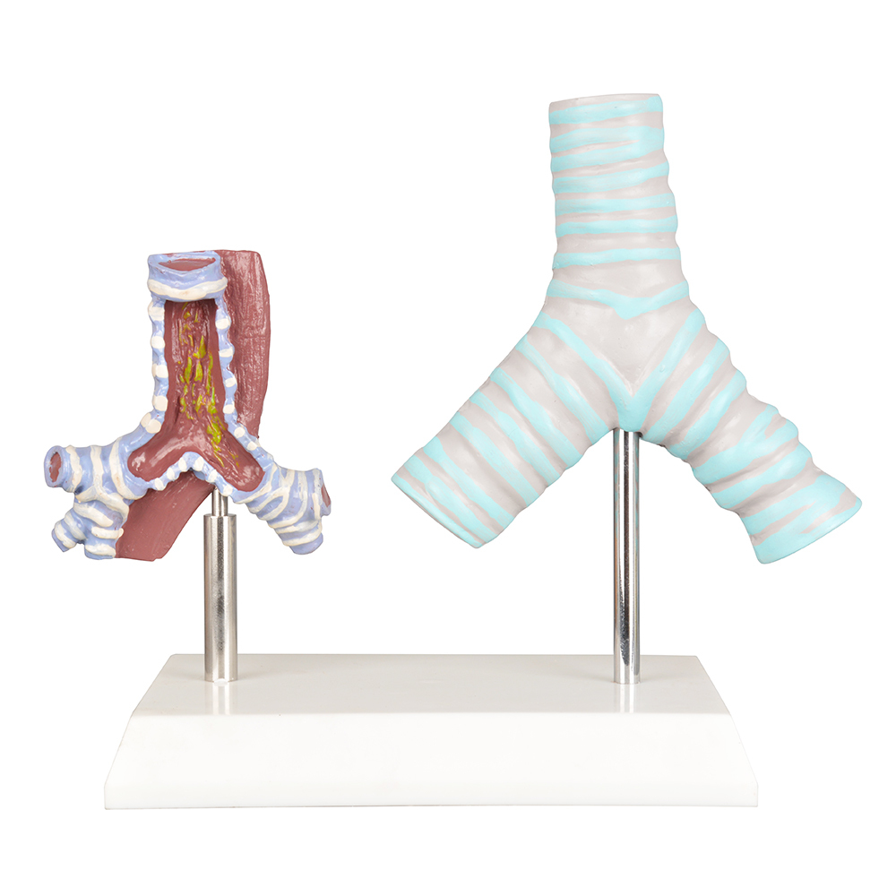 Healthy vs Smoker Trachea Model